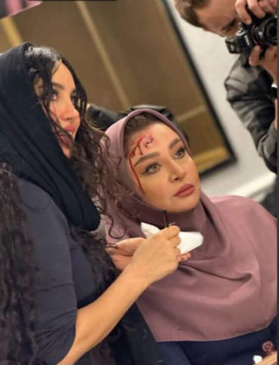 عکس | تست گریم جالب مهلقا باقری با سری خونین!