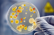 کشف رده جدیدی از آنتی‌بیوتیک‌ها که باکتری‌های مقاوم را نابود می‌کند
