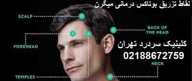 آیا تزریق بوتاکس می تواند در درمان میگرن مزمن اثر بخش باشد؟