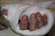 قطع انگشتان کودک ۲ ساله در چرخ گوشت | پدر و مادر بچه کجا بودند؟