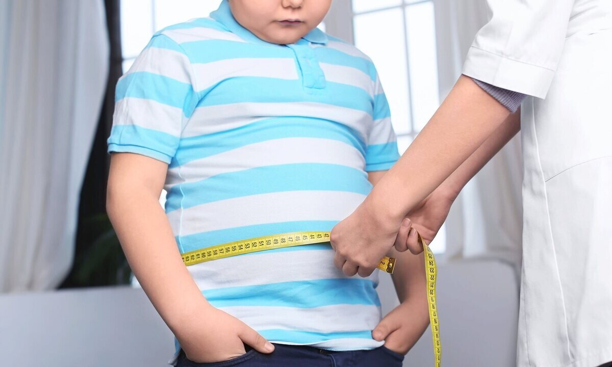 چاقی کودکان