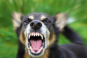 سگ گزیدگی؛ ماموریت روزمره در مراکز درمانی! | حجم بالای حمله سگ های بدون صاحب به شهروندان | ویدئو
