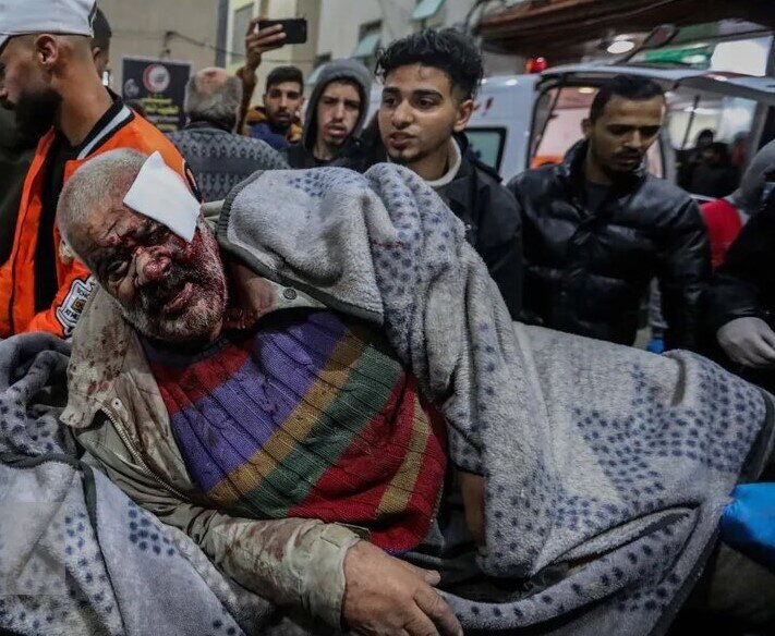 این جنگ نیست یک حمام خون بیپایان است ؛ مشاهدات تکاندهنده پزشک غزهای | تنها کاری که ما ۱.۴ میلیون نفر میتوانیم انجام دهیم ...