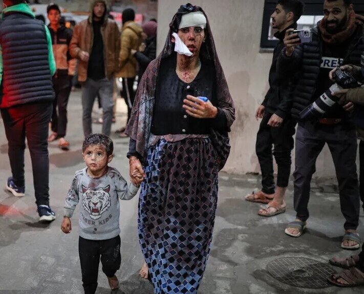 این جنگ نیست یک حمام خون بیپایان است ؛ مشاهدات تکاندهنده پزشک غزهای | تنها کاری که ما ۱.۴ میلیون نفر میتوانیم انجام دهیم ...