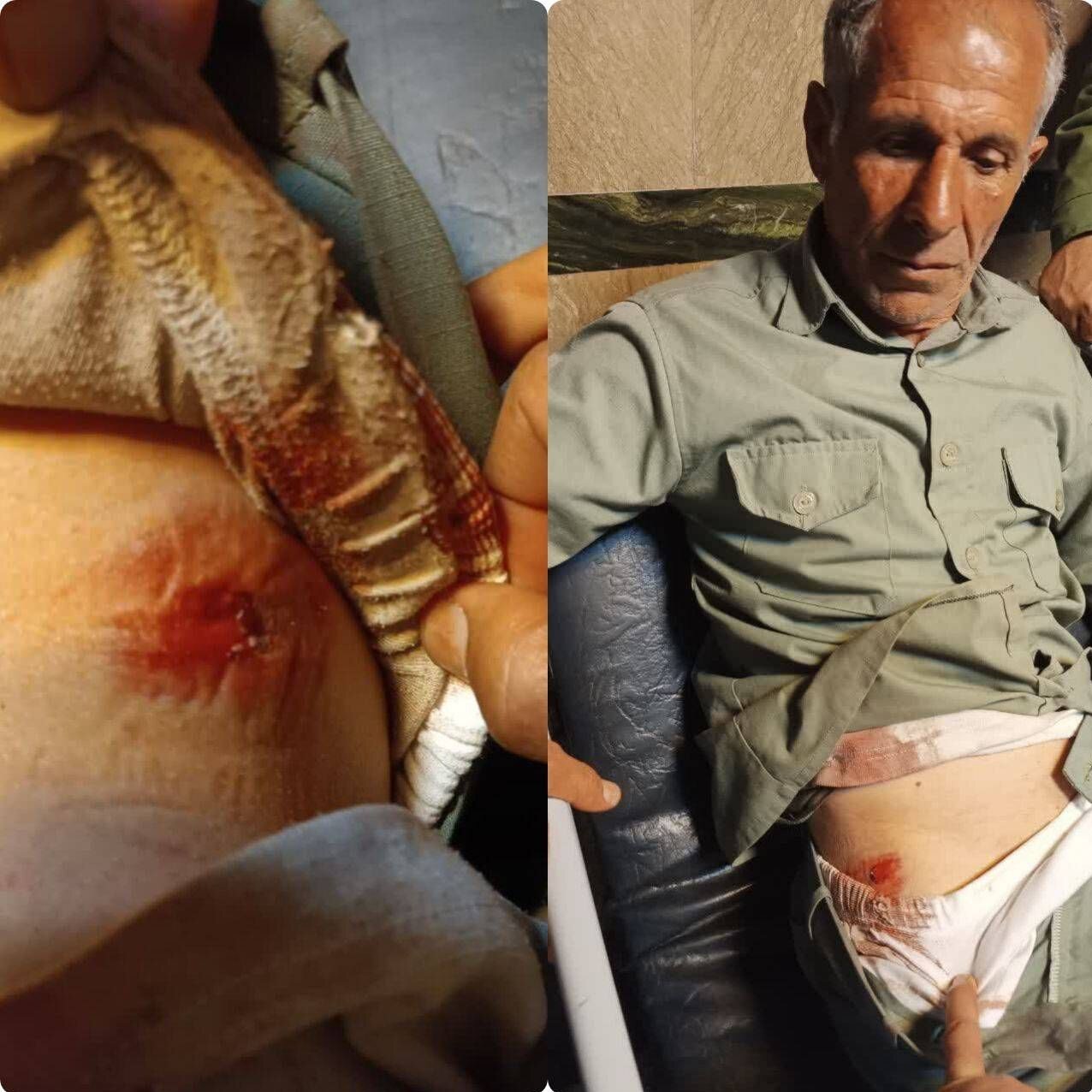 تیر خوردن محیطبان در درگیری با شکارچیان | تصویر این محیطبان مجروح را ببینید