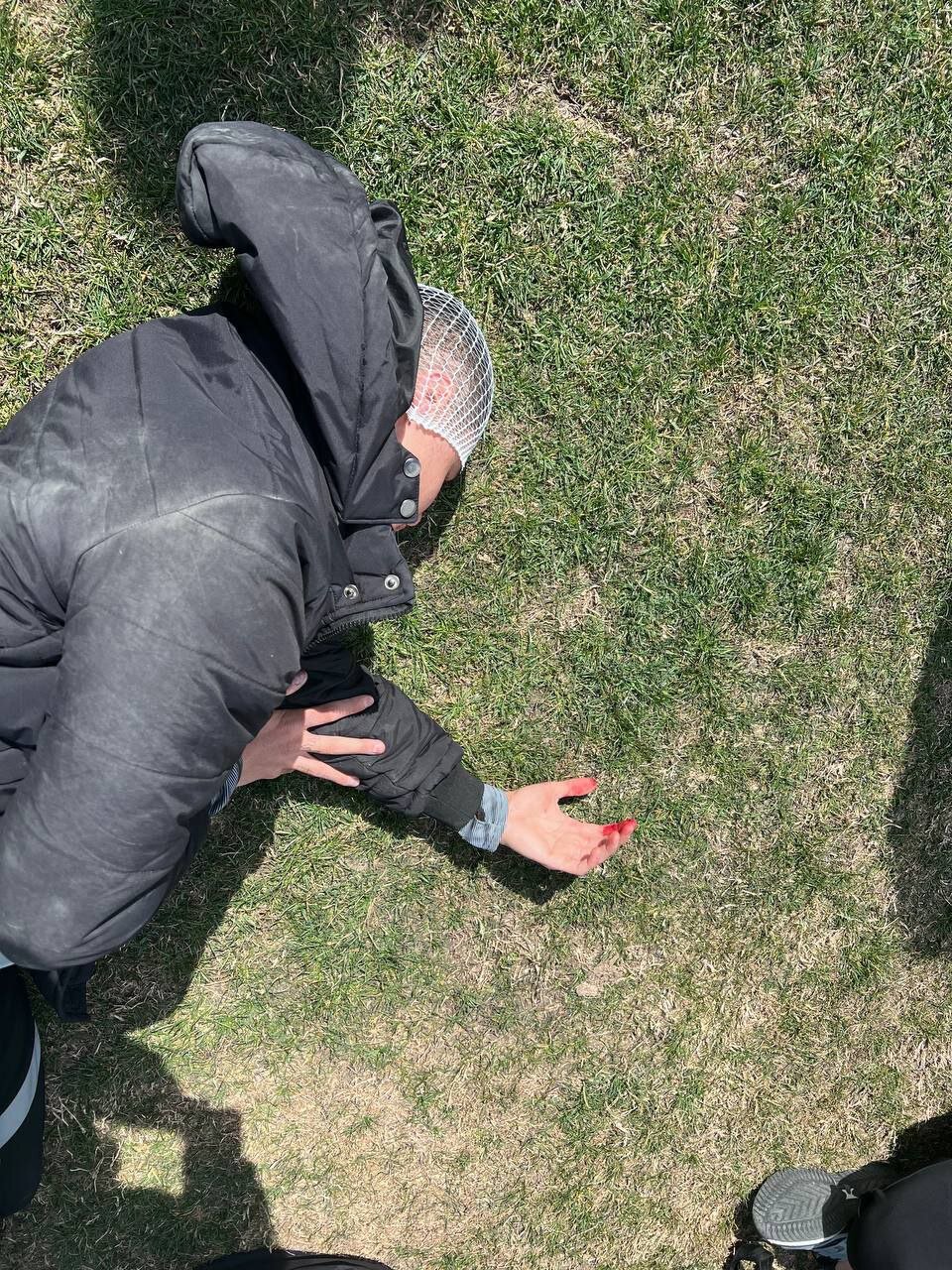 جدیدترین تصاویر از چاقو کشی روی بازیکنان تراکتورسازی