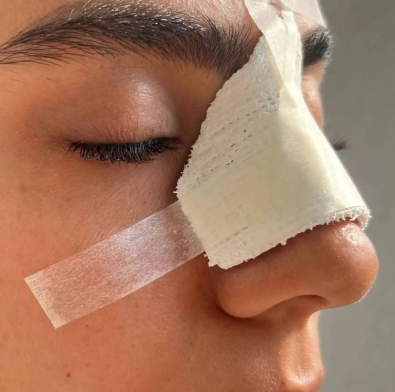 تصاویر خونریزی و خشونت شدید در فوتبال زنان ایران | ۳ بازیکن بستری شدند