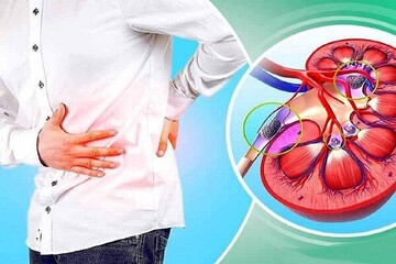 آیا ماءالشعیر برای دفع سنگ کلیه مفید است؟
