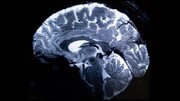 ثبت واضح‌ترین تصویر مغز با فناوری جدید