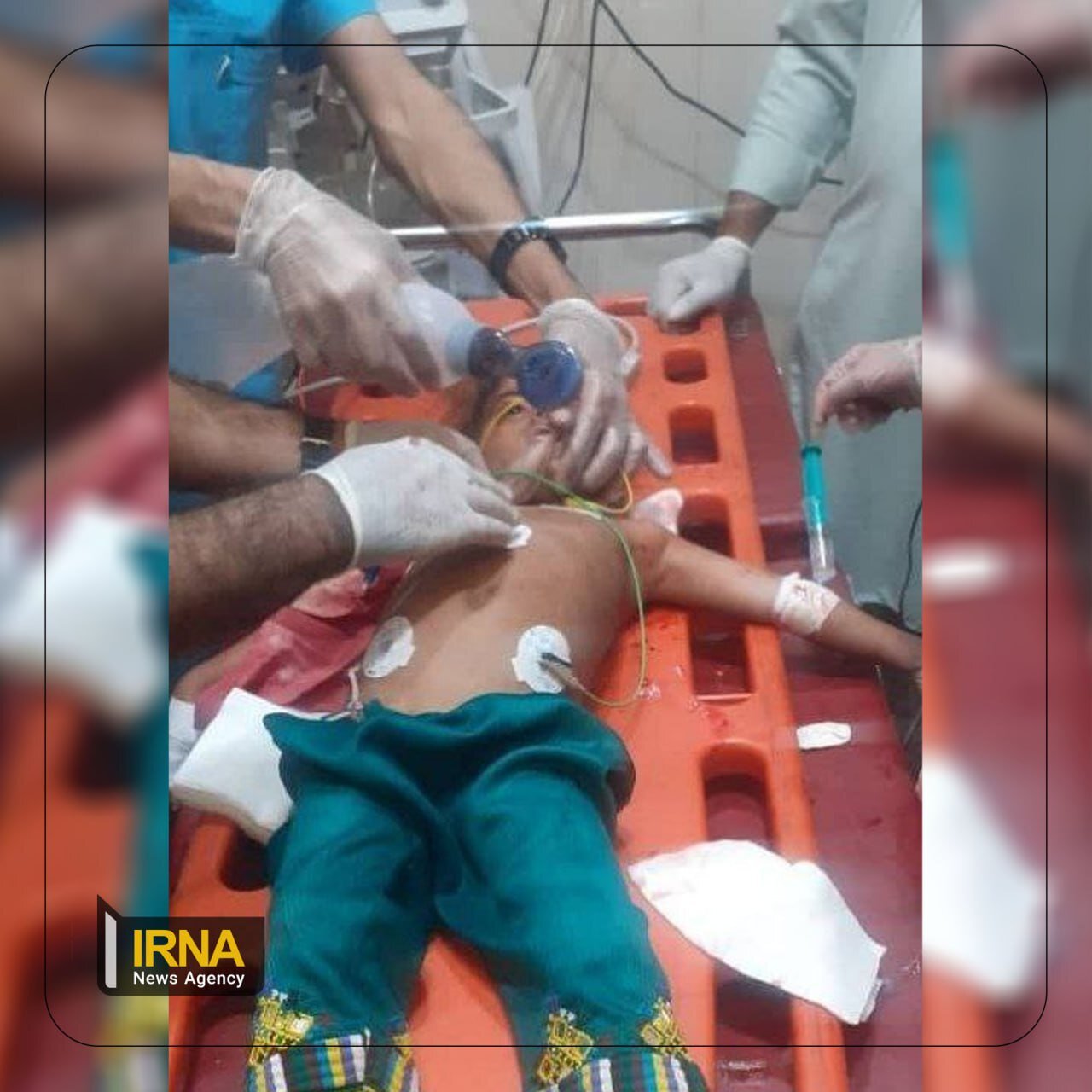 تصویر کودک بلوچ که در حملات تروریستی گروهک جیش الظلم مجروح شده