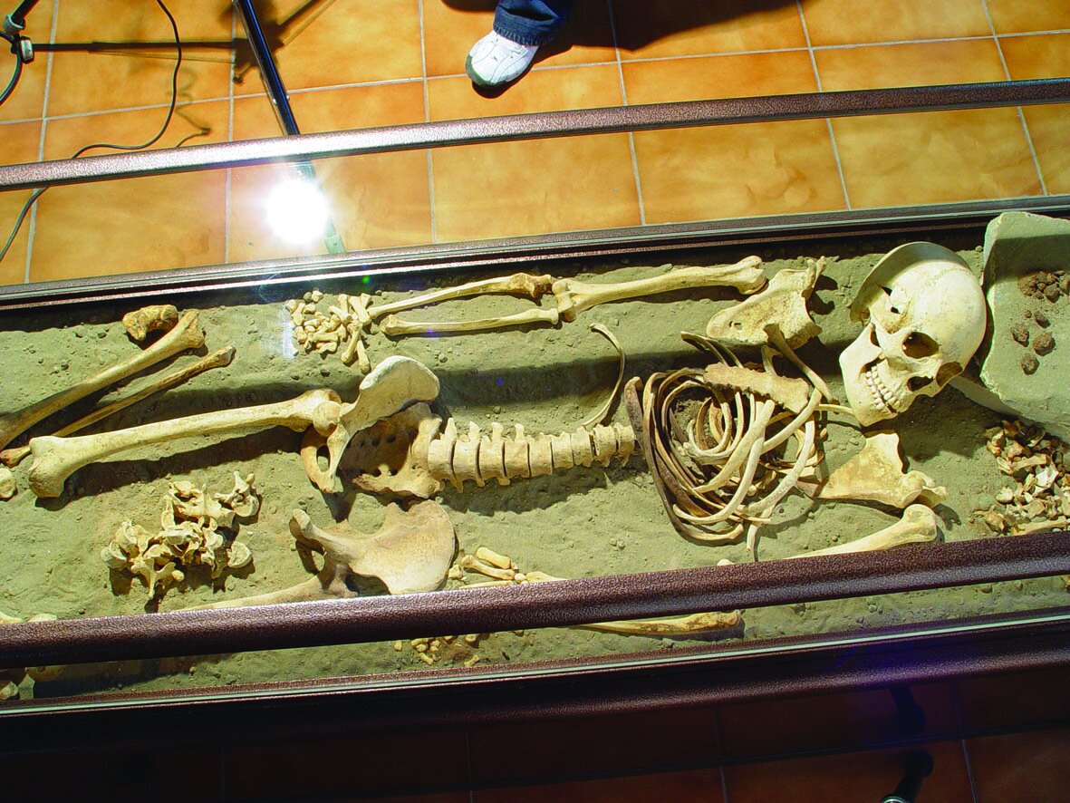 نخستین تجهیزات پزشکی تا مومیایی را اینجا ببینید| تاریخ پزشکی در عمارت قجری