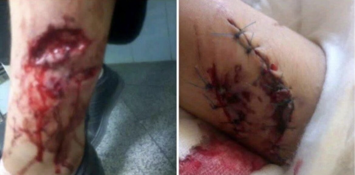 سگهای ولگرد یک دانشآموز را تکه و پاره کردند + عکس