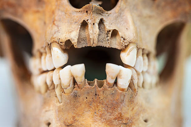 براده‌های دندان عجیب و غریب از بقایای مردان در جزیره گوتلند بالتیک