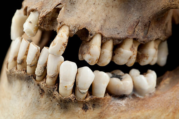 براده‌های دندان عجیب و غریب در جزیره گوتلند بالتیک | وایکینگ‌ها با دندان‌های‌شان چه می‌کردند؟