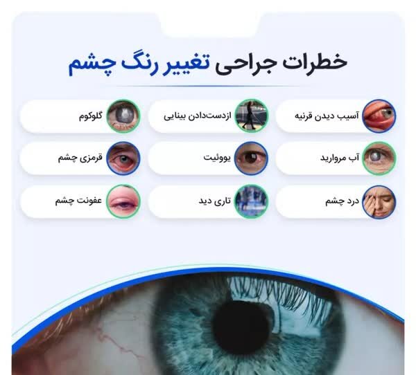 افزایش آمار این عمل زیبایی ۳۰۰ میلیونی!