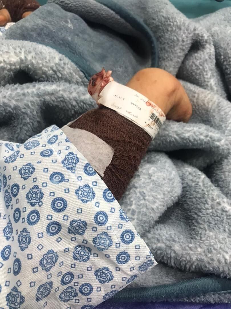 بیرون کشیدن پسر بچه ۱۲ساله از میان آرواره های سگ بدون صاحب در کرج ! | تصاویر