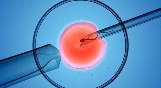 آشنایی با روش میکرواینجکشن در لقاح مصنوعی