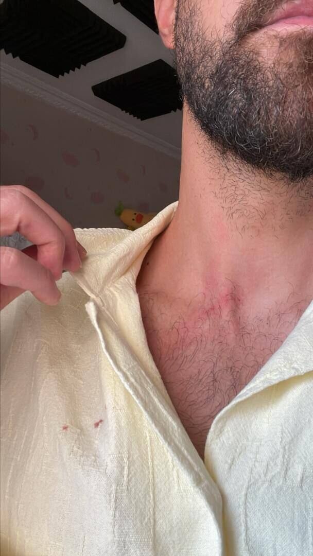 حمله خفتگیرهای خشن به مهاجم استقلالی | عکس