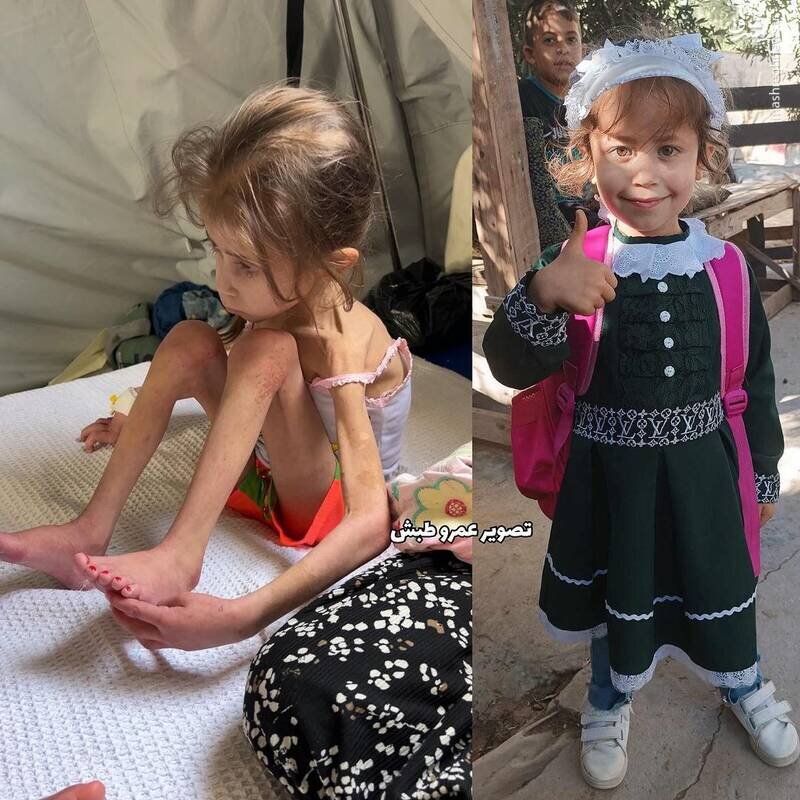 عکس باورنکردنی از دختر بچه فلسطینی قبل و بعد حمله اشغالگران به غزه