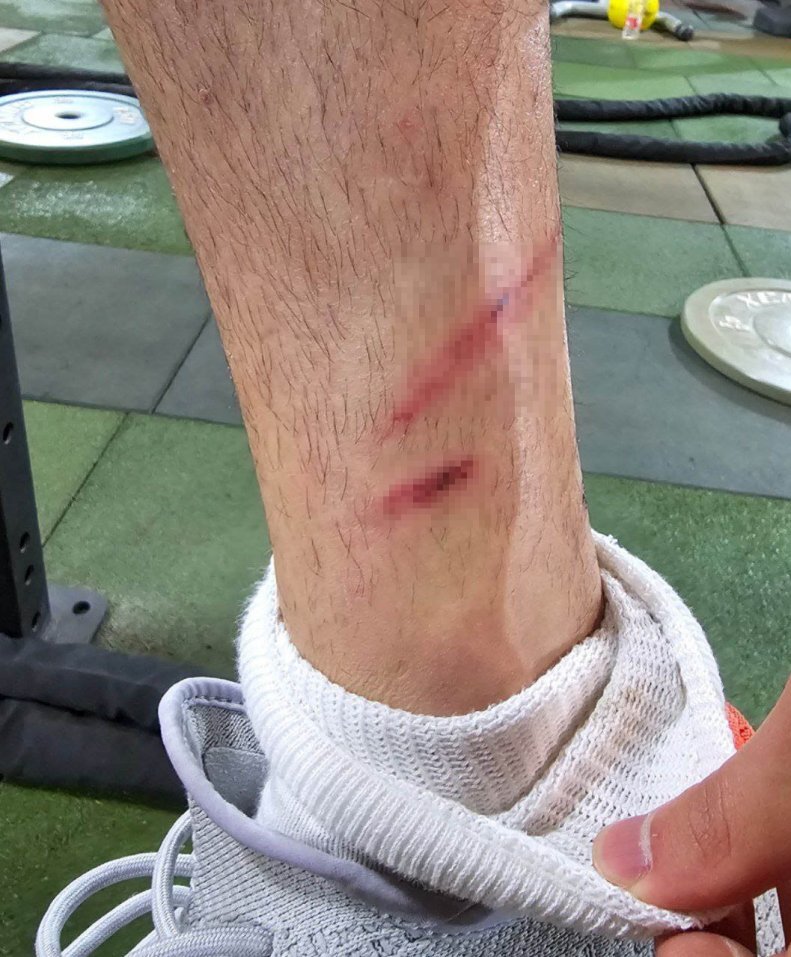 سپاهانی‌ها اورونوف را به چه روزی انداختند | تصاویری از پای زخمی ستاره پرسپولیس بعد از بازی حساس | داور حتی کارت زرد هم نداد