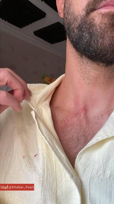 این شهروند باید به پلیس اعتماد کند | واکنش پلیس به حمله سارقان به مهاجم سابق استقلال تهران