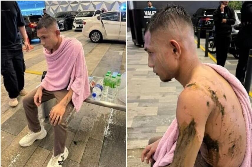 عکس| اسیدپاشی به بازیکن ملی پوش | تن ستاره جوان سوخت