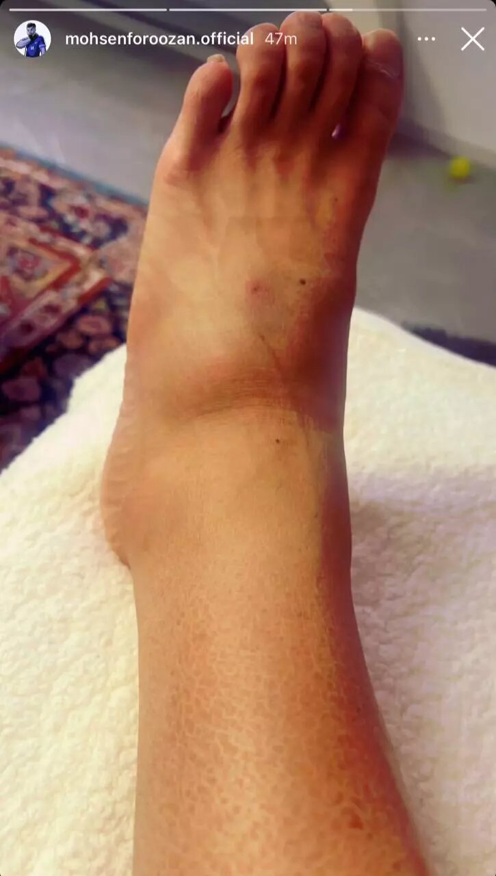 عذرخواهی بعد از شب جنجالی در آزادی ؛ دوستتون دارم! | عکس