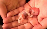 آمار عجیب از سقط جنین در منزل | ویدئو