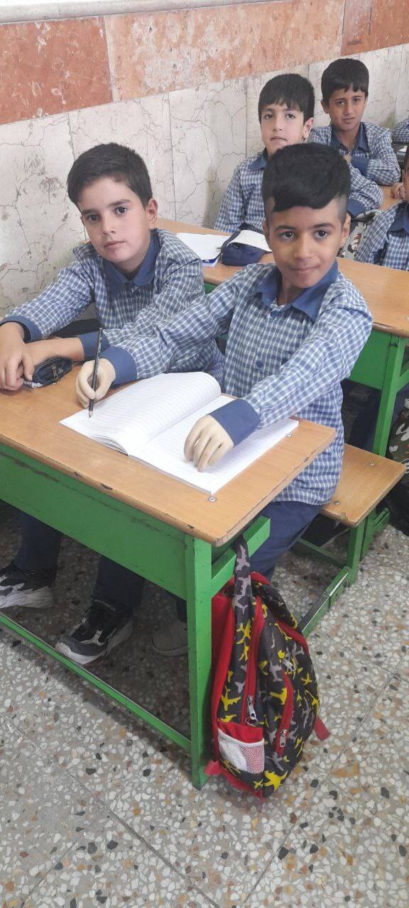 این پسر با دستهای مصنوعی دروازه بانی می کند