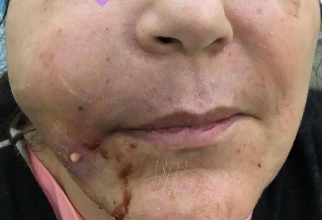 هشدار وزارت بهداشت به پزشکان عمومی: تیغ زیبایی را زمین بگذارید | روایت افرادی که سلامتی خود را به خطر انداختند + تصاویر +16