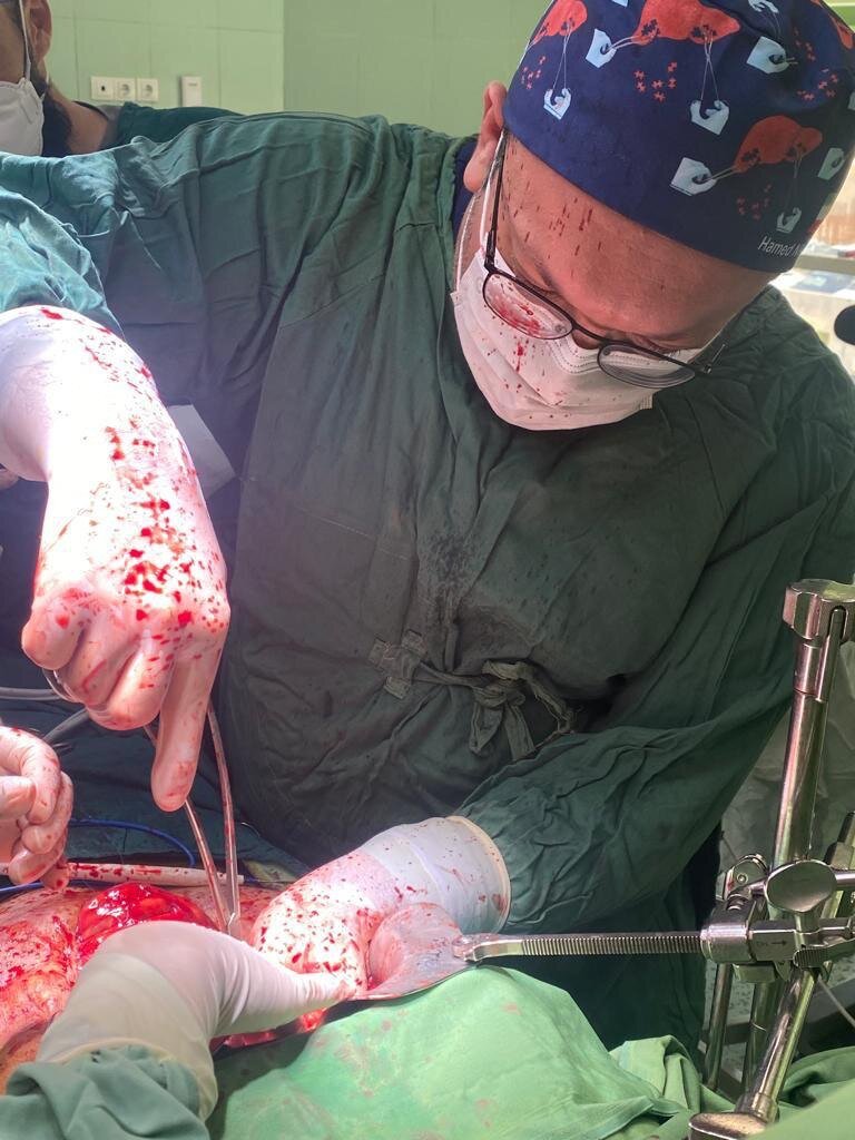 هزینه پیوند روده در آمریکا ۲.۱ میلیون دلار، در ایران ۲۸۰ میلیون تومان | داروی ۱۰ هزار دلاری نجاتبخش بیماران است و نداریم | روده هم سکته میکند