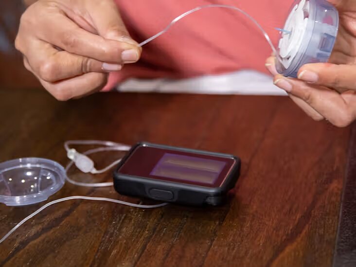 اخبار امید بخش از درمان دیابت نوع ۲