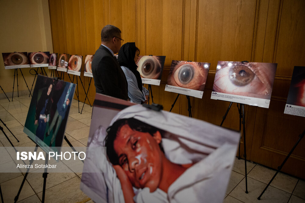 قاب هایی از نمایشگاه عکس زنان و کودکان جانباز سردشتی | تصاویر