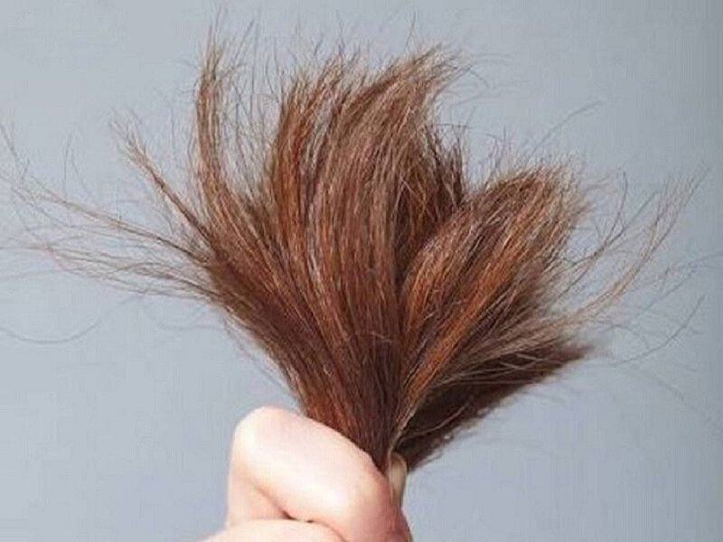 چطور از موخوره پیشگیری کنیم؟ | راز موهای درخشنده و با طراوت با این چند روش ساده