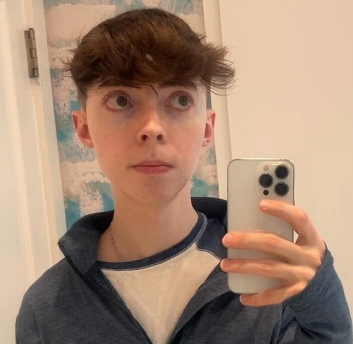 راز جوان ماندن مرد ۳۵ سالهای که شبیه نوجوانان ۱۵ ساله است | عکس چهره نوجوان مانده این مرد را ببینید ؛ به هیچ نوع اختلال هورمونی مبتلا نیست