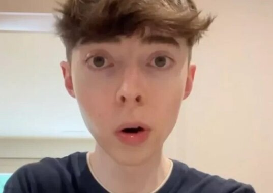 راز جوان ماندن مرد ۳۵ سالهای که شبیه نوجوانان ۱۵ ساله است | عکس چهره نوجوان مانده این مرد را ببینید ؛ به هیچ نوع اختلال هورمونی مبتلا نیست