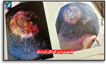 جنایتهای مرد قصاب در مشهد ؛ از فروش گوشت الاغ تا کودکآزاری + عکس