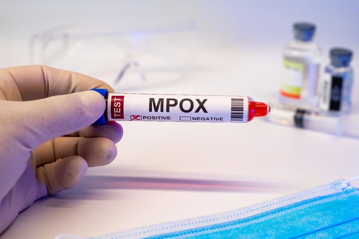 mpox