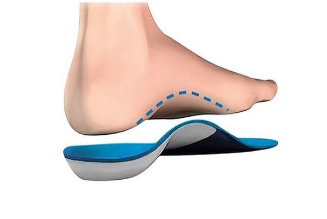 آیا سبک زندگی تاثیری در ایجاد یا شدت کف پای صاف دارد؟