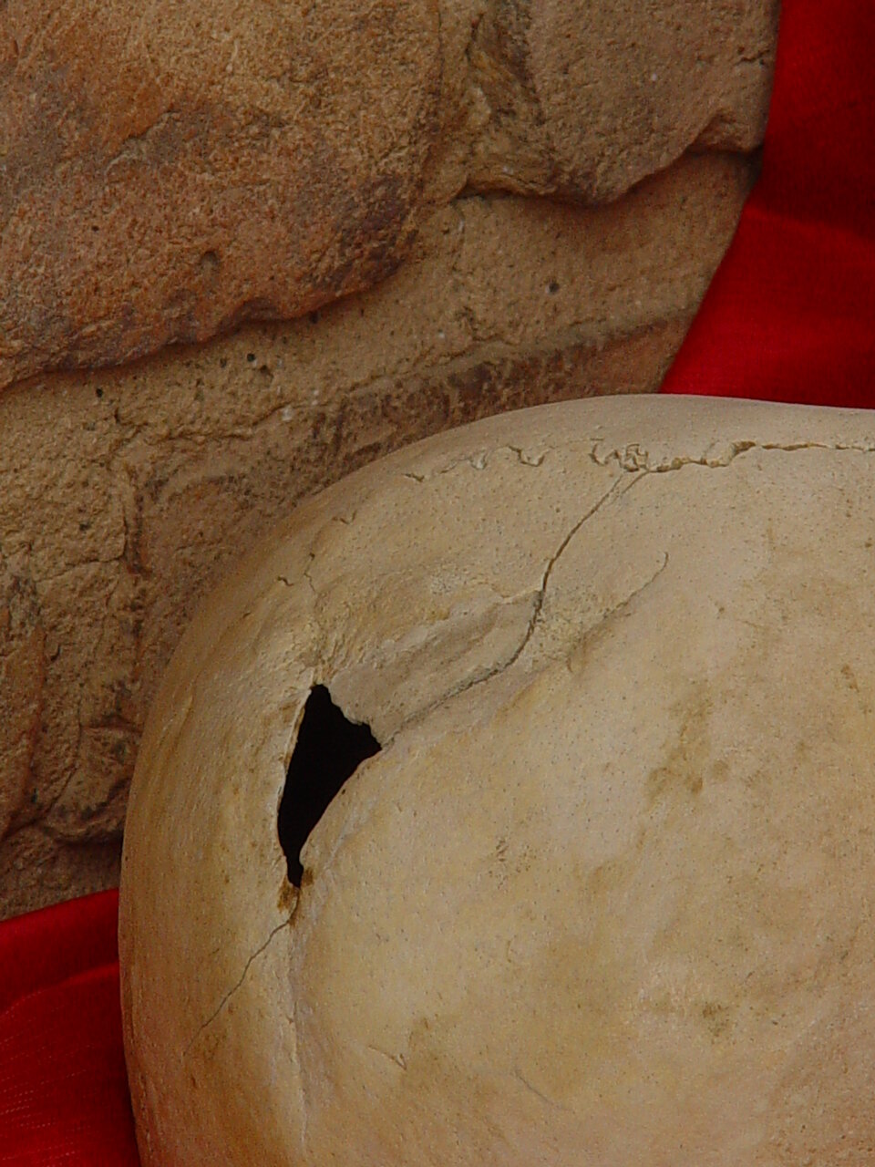 پزشکی؛ از پارینهسنگی تا سفالینههای درمانی