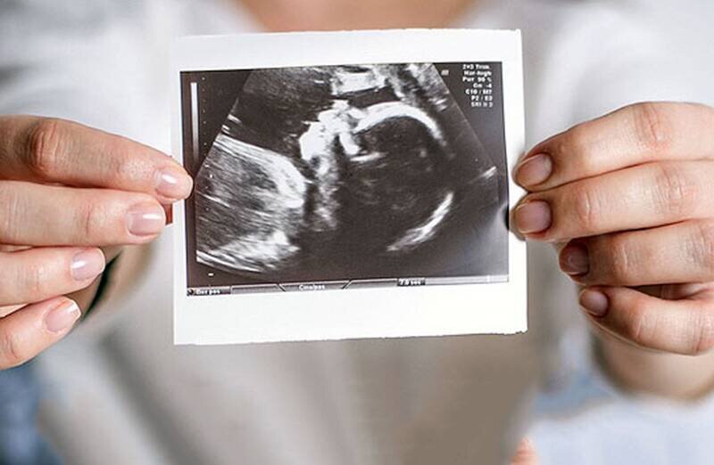 بهترین سن باروری در زنان ؛ فاصله ایدهآل بین زایمان ها چند سال است؟