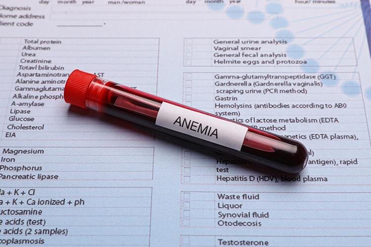 لیست بهترین آجیلها برای کم خونی