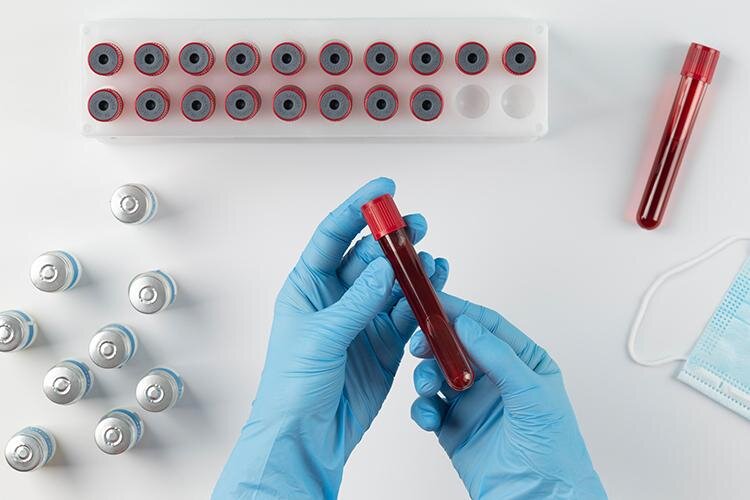 لیست بهترین آجیلها برای کم خونی