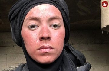 تغییر چهره بازیگر پایتخت که از داعش فرار کرده بود | ببینید