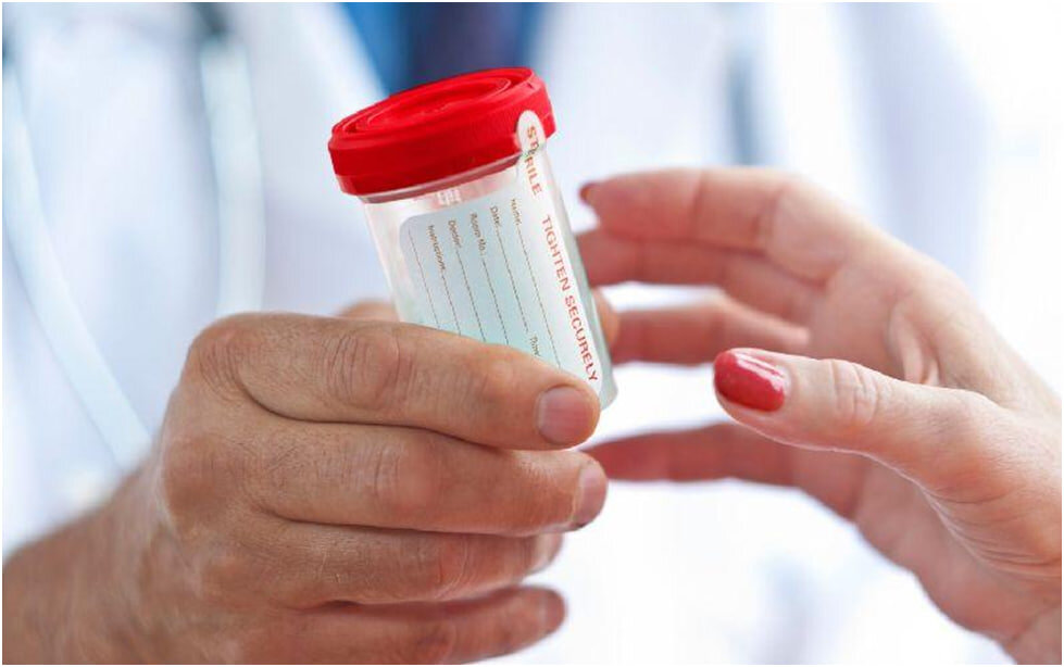 تست اعتیاد طب کار چیست و شامل چه مواردی میشود؟