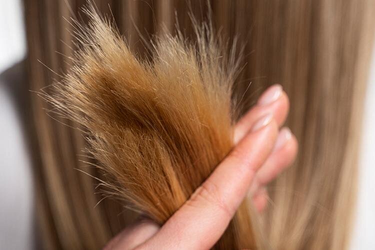 چرا به موخوره دچار میشویم؟ + روشهای درمان 4 چگونه از شر موخوره خلاص شویم! + روش های خانگی درمان موخوره