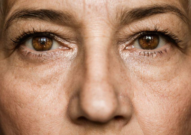 عمل آب مروارید چیست؟ + جزئیات 3 دوران نقاهت بعد از عمل آب مروارید