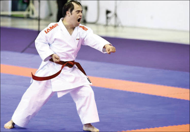 این بیماران سندرم داون معروف شدند | روایت پسر ۹ ساله سندرم داون که بازیگری را تجربه کرد