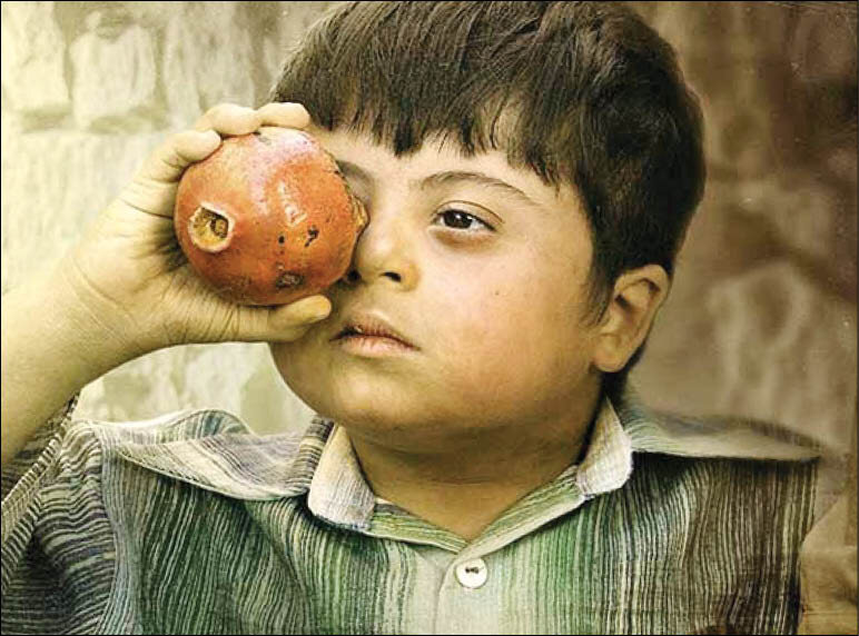 این بیماران سندرم داون معروف شدند | روایت پسر ۹ ساله سندرم داون که بازیگری را تجربه کرد