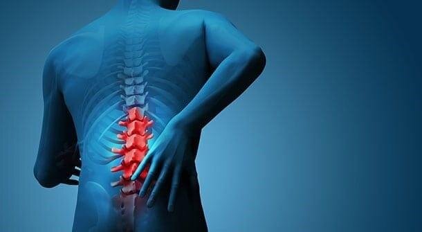 سیاتیک چیست؟ تعریف، علائم و روش درمان 1 سیاتیک چیست؟ تعریف، علائم و روش درمان